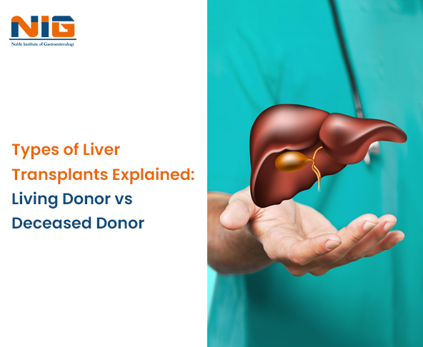 Types of Liver Transplants Explained: Living Donor vs Deceased Donor