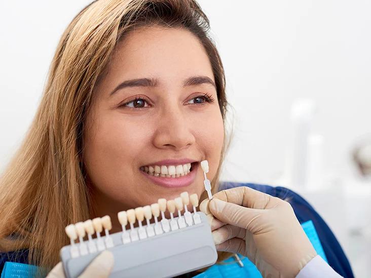 Dental Veneers: The Fastest Way to Transform Your Smile | Lebanon Hub