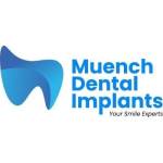 Muenchdental Implants Implants